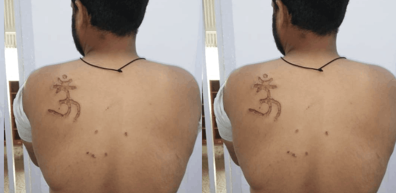 Indian Court Orders Inquiry After Muslim Man Branded With 'Om' Symbol