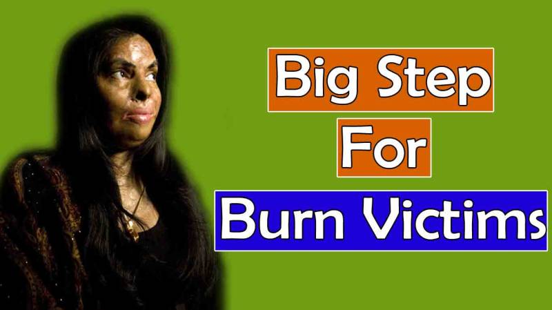 A big step for burn victims