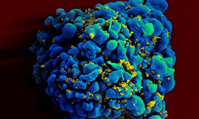 Huge Breakthrough in Aids Treatment; New Study Discovers Drugs Stopping The Disease From Spreading
