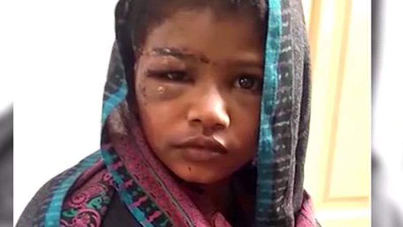 Tayyaba Torture Case: Defence Lawyer Claims Before Supreme Court that the Bruises on Victim’s Body were Accidental