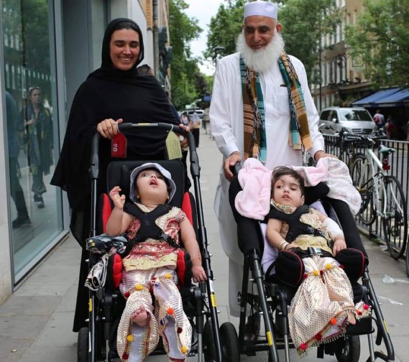 Little Girls From Charsadda: Sisters Conjoined At Head Are Now living Independent Life After Complex Surgery In London