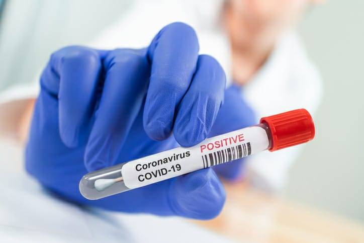 Pakistan’s First Covid-19 Testing Kit Approved For Usage