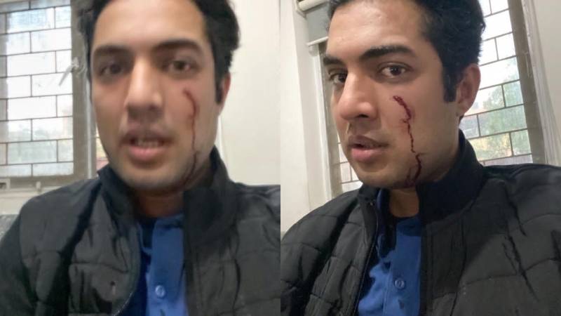 Journalist Iqrar ul Hassan Injured In Attack By Unknown Assailants